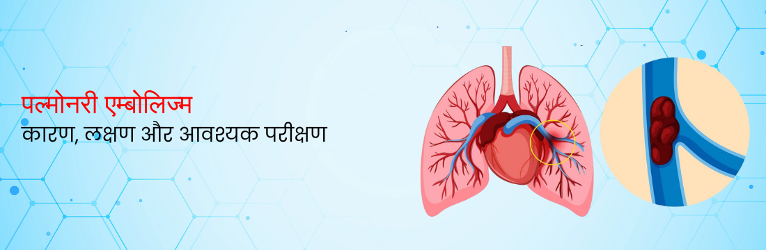 पल्मोनरी एम्बोलिज्म: कारण, लक्षण और पहचान के लिए आवश्यक परीक्षण